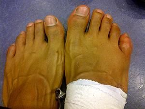 Девід Хей: Не переміг Кличка через зламаний палець Девід Хей: Не переміг Кличка через зламаний палець