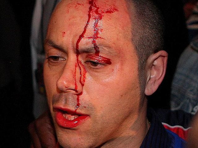 Фотохроніка: Після бою з Кличком Чізора поштовхався з Хеєм Фотохроніка: Після бою з Кличком Чізора поштовхався з Хеєм