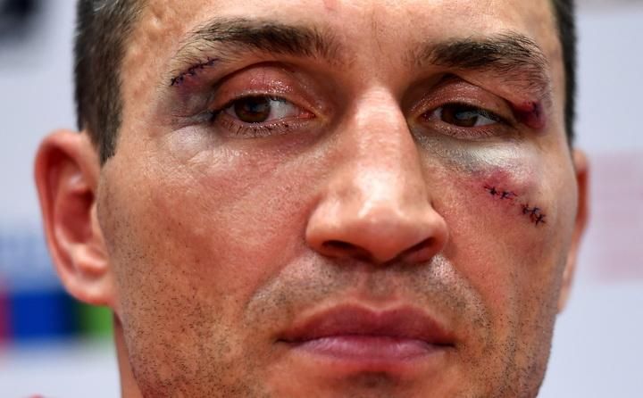 Стало известно, когда состоится матч-реванш Кличко и Фьюри Стало известно, когда состоится матч-реванш Кличко и Фьюри