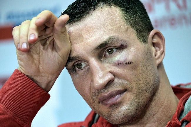 Чемпионский пояс WBO разыграют на мини-турнире без участия Кличко