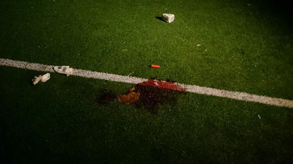 В Черногории во время тренировки застрелили футболиста