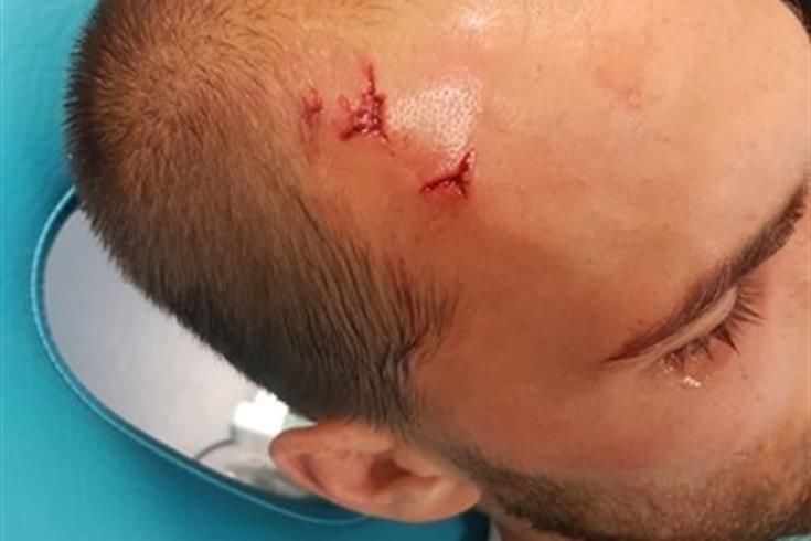Фанати напали на футболістів "Спортінга" на тренувальній базі: є поранені