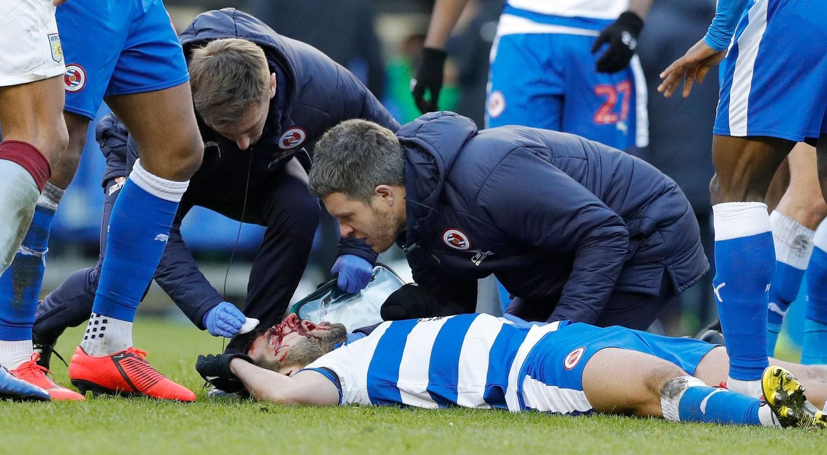 В Англии футболисту наступили на голову, его в ужасном состоянии доставили в больницу: видео 18+