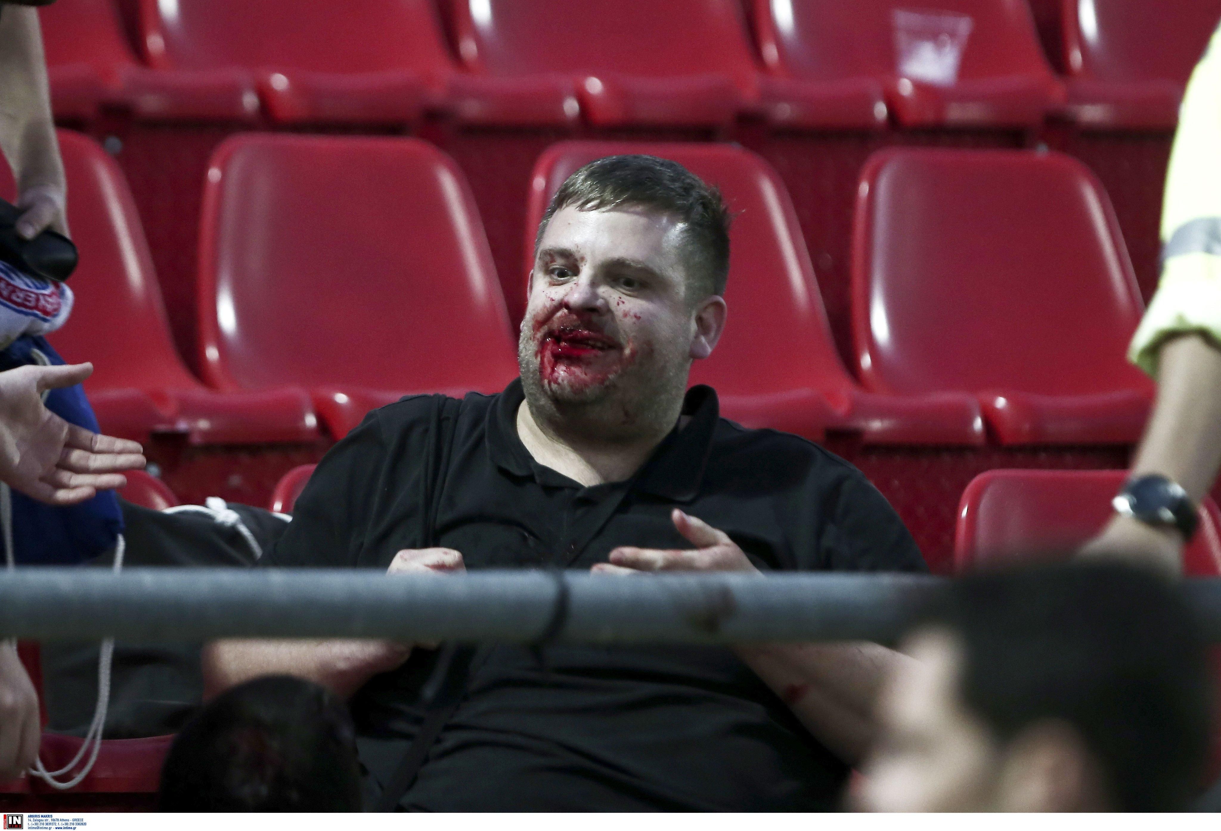 На матче юношеской Лиги чемпионов фанаты атаковали соперников палками: кровавые фото и видео 18+