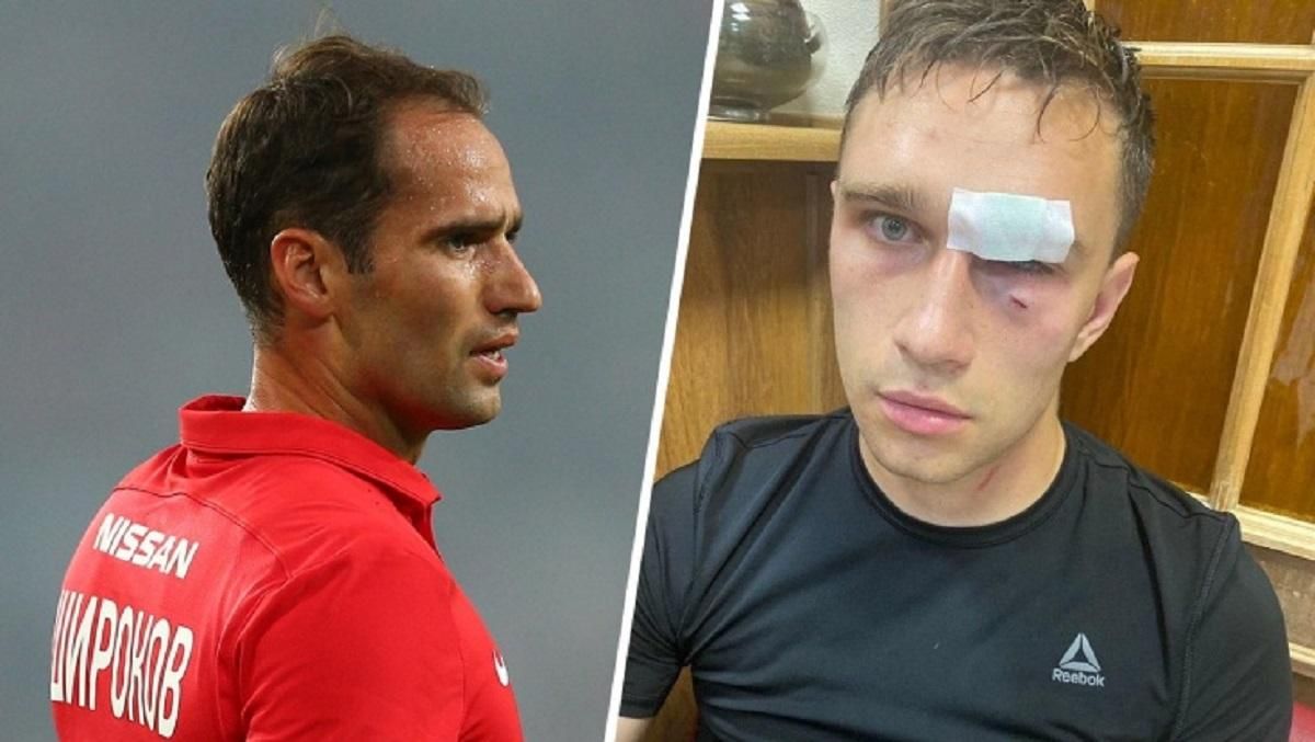 Як виглядає обличчя арбітра, якого побив ексфутболіст збірної Росії Широков: фото Як виглядає обличчя арбітра, якого побив ексфутболіст збірної Росії Широков: фото