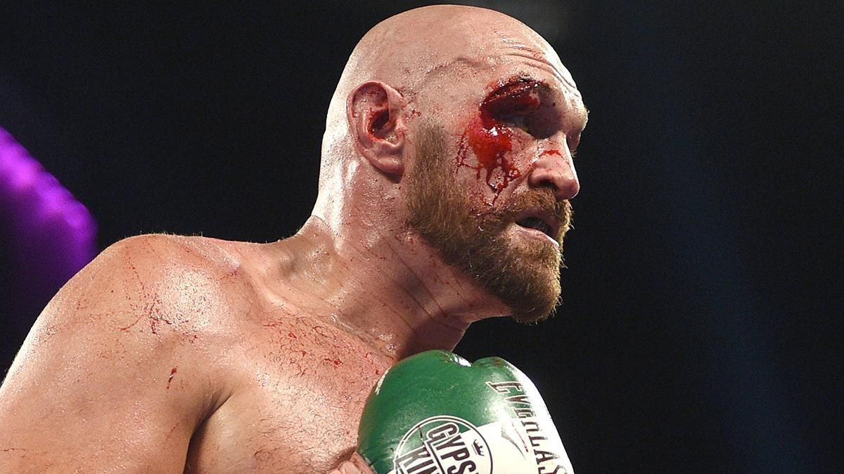 Дату реваншу Ф'юрі – Уайлдер скасували: бій може відбутися раніше Дату реваншу Ф'юрі – Уайлдер скасували: бій може відбутися раніше