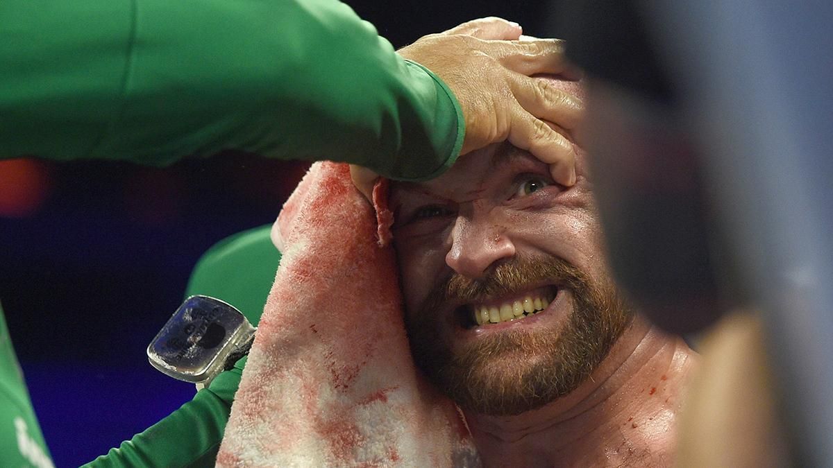 Джошуа – Ф'юрі: WBC виступила за організацію бою Джошуа – Ф'юрі: WBC виступила за організацію бою