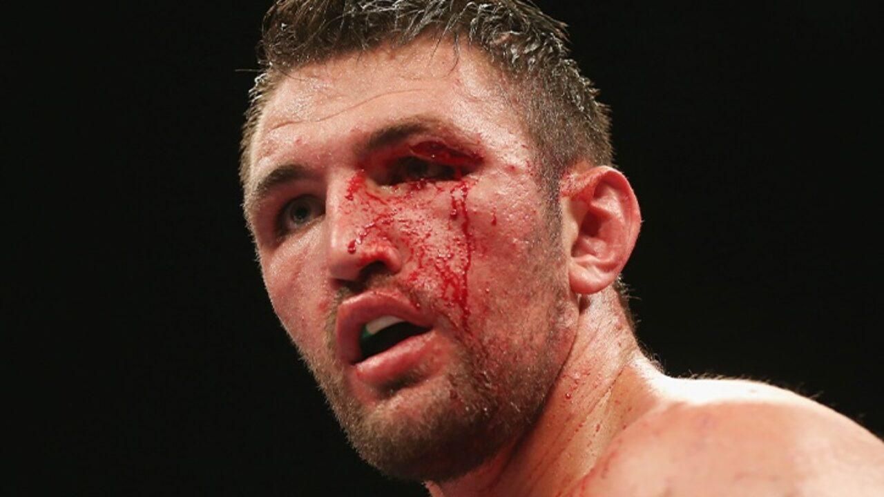 Криваве місиво: молодший брат Ф'юрі завдав поразки колишньому супернику Кличка – відео Криваве місиво: молодший брат Ф'юрі завдав поразки колишньому супернику Кличка – відео