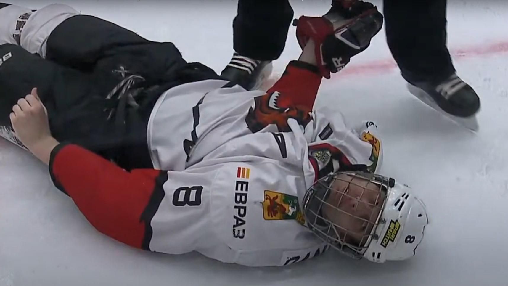Російський хокеїст вдарив головою об лід суперника, який втратив свідомість: відео