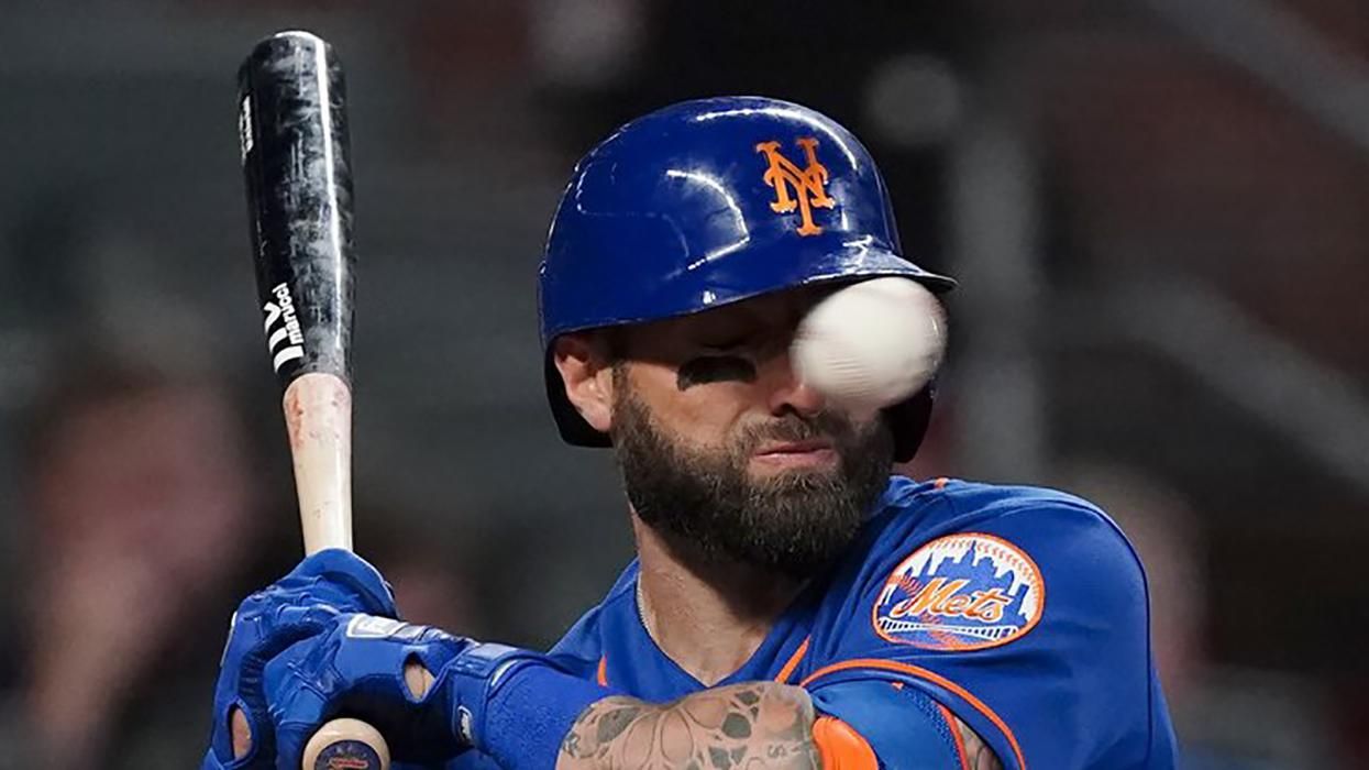 Бейсболисту попали мячом в нос со скоростью 150 километров в час Бейсболисту попали мячом в нос со скоростью 150 километров в час