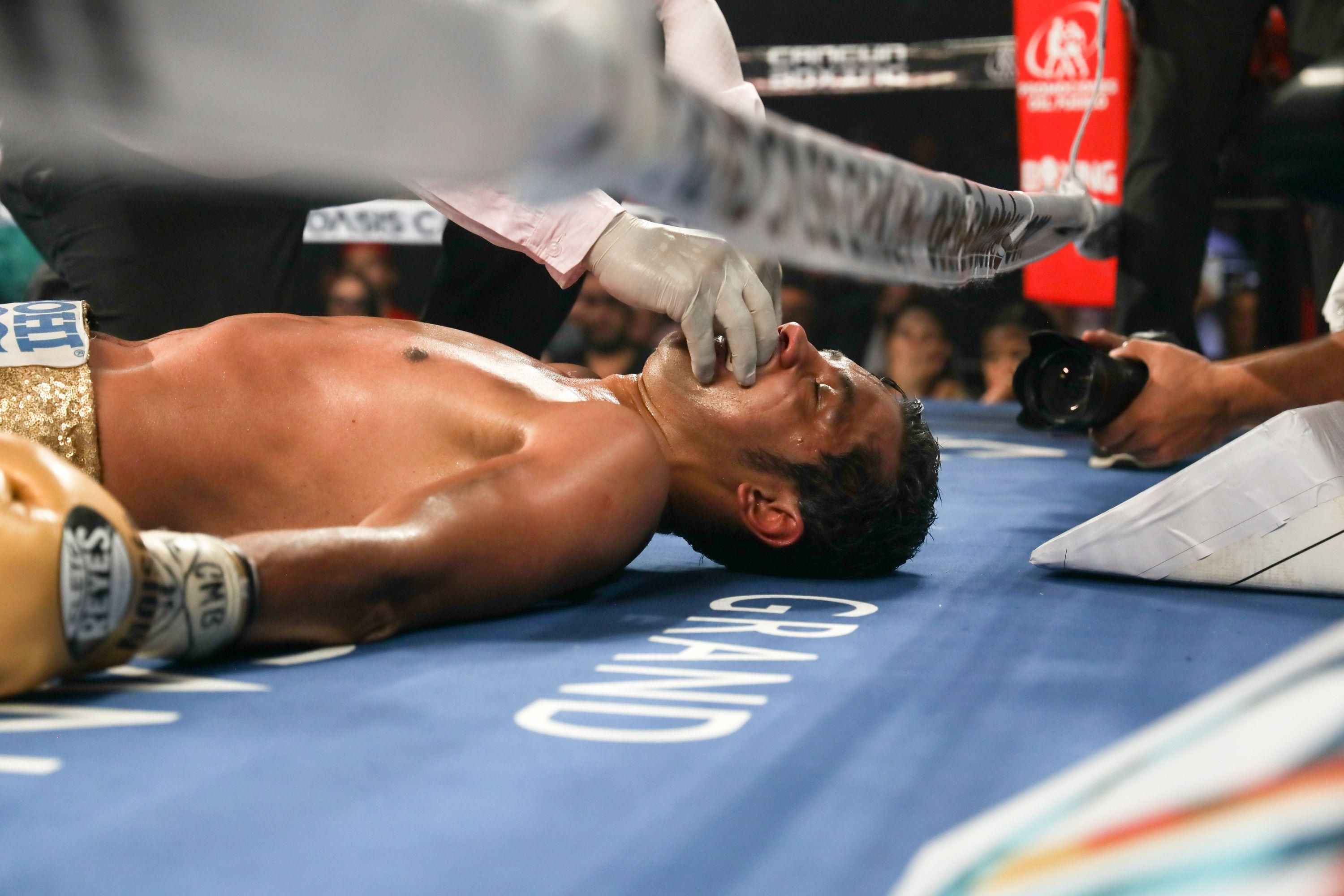 Бывший чемпион мира в коме после страшного нокаута в челюсть: видео Бывший чемпион мира в коме после страшного нокаута в челюсть: видео