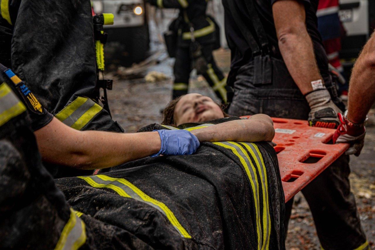 7-летняя девочка, пострадавшая от ракетных обстрелов Киева, занималась художественной гимнастикой 7-летняя девочка, пострадавшая от ракетных обстрелов Киева, занималась художественной гимнастикой