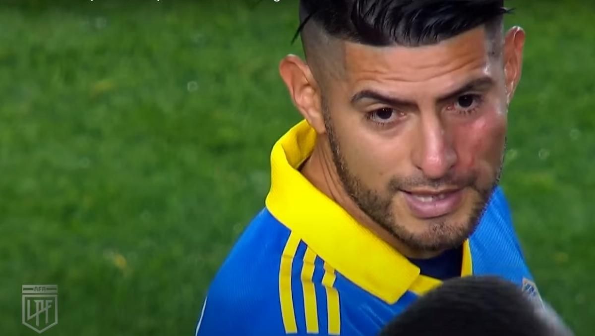 Карлос Самбрано зі слідом від удару на обличчі Карлос Самбрано зі слідом від удару на обличчі