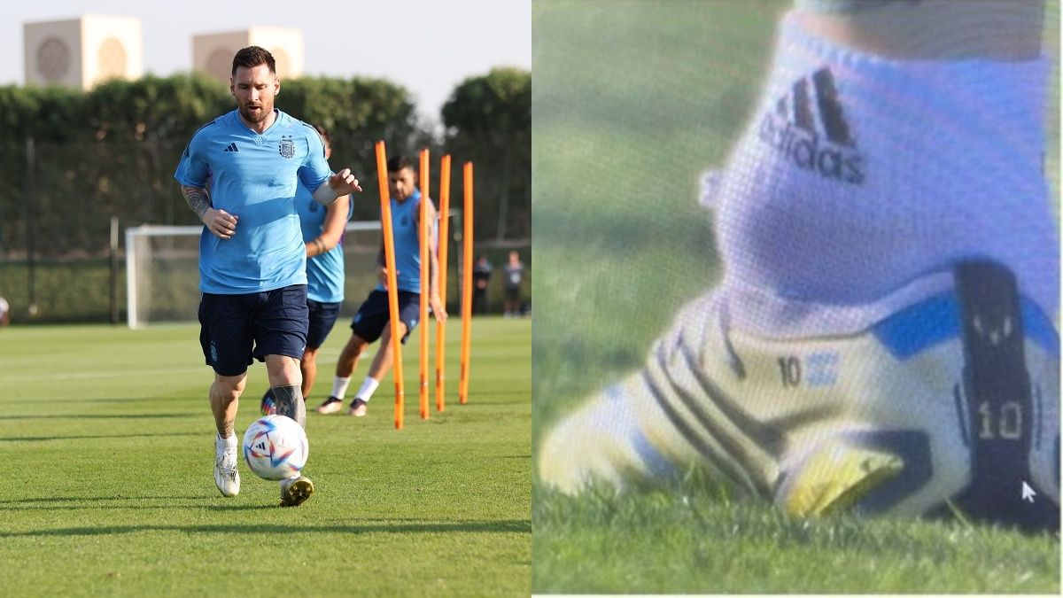 ЧМ-2022 – что не так с суставом Месси перед игрой Аргентина – Саудовская Аравия ЧМ-2022 – что не так с суставом Месси перед игрой Аргентина – Саудовская Аравия