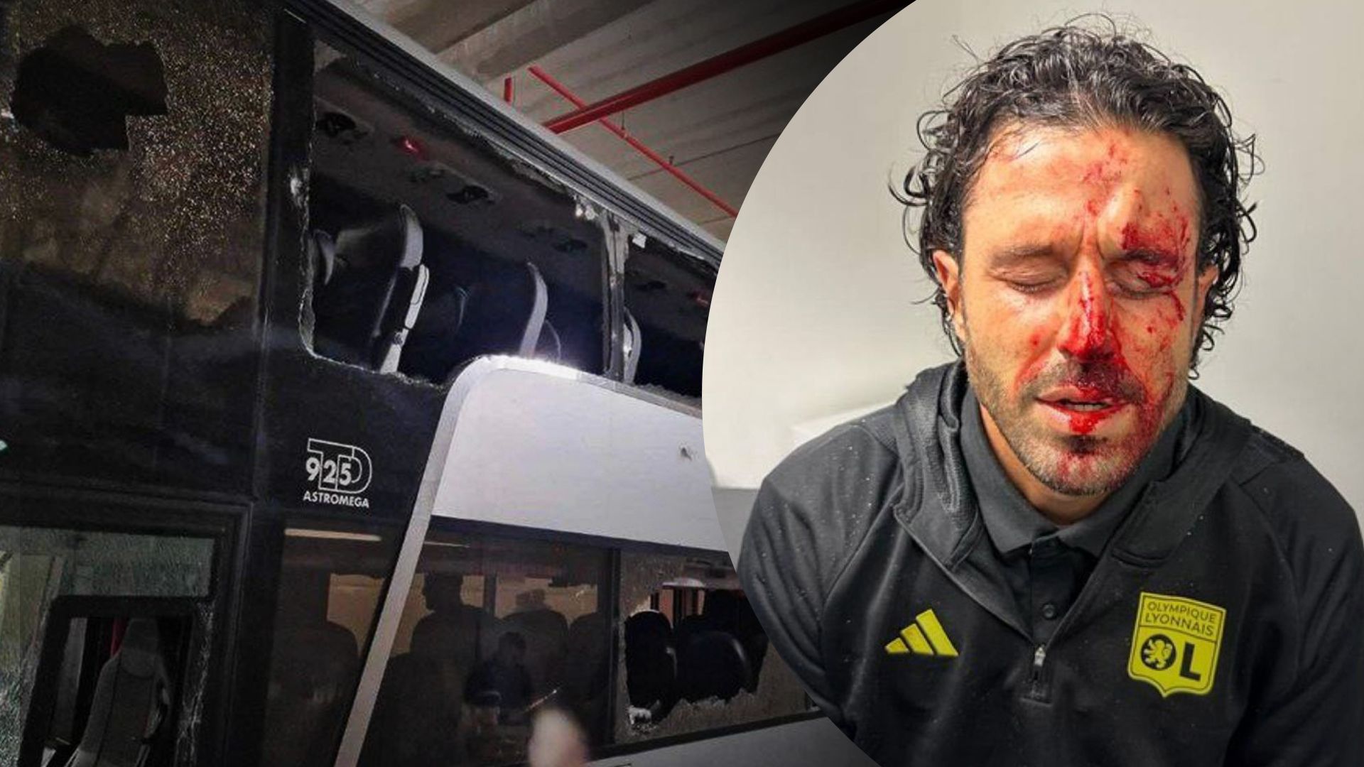 Фабіо Гроссо дісталось від фанатів Марселя Фабіо Гроссо дісталось від фанатів Марселя