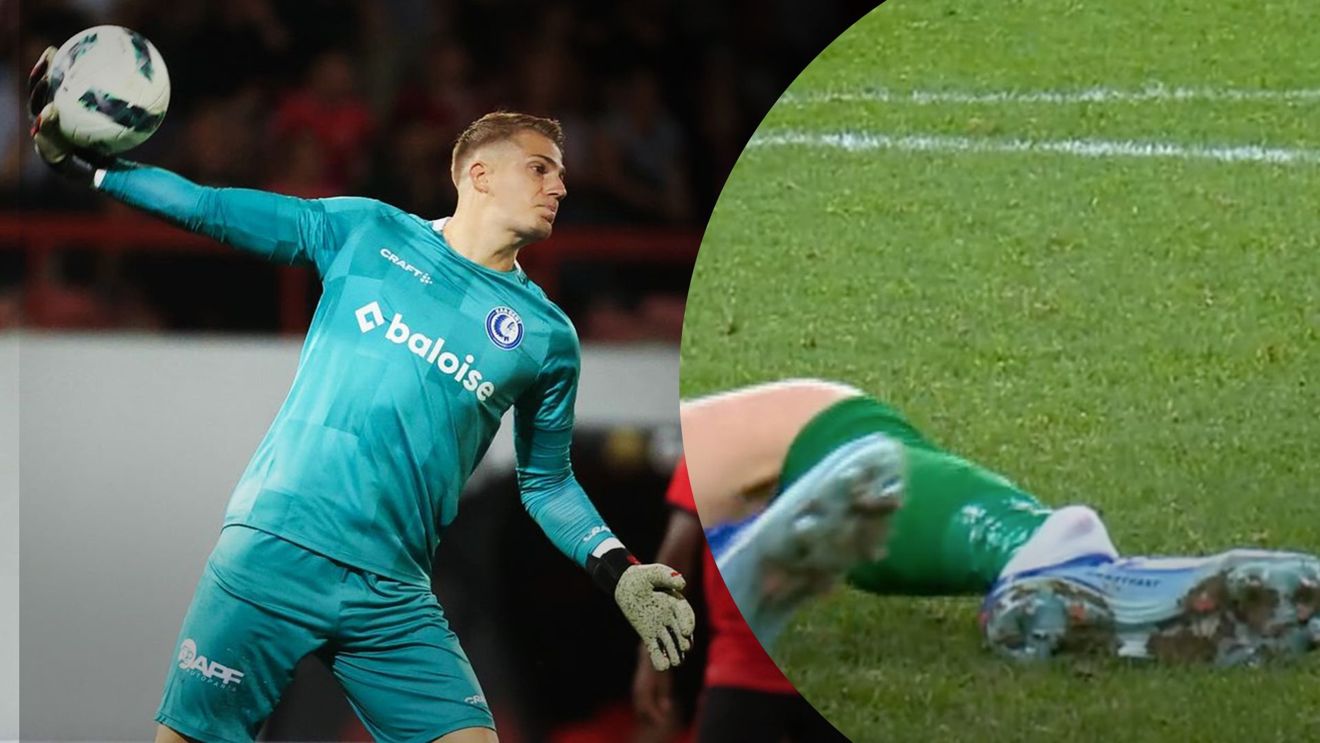 Поль Нарди сломал ногу Поль Нарди сломал ногу