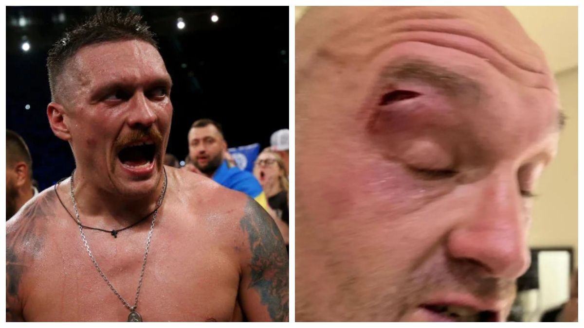 Що відомо про чергове перенесення бою Що відомо про чергове перенесення бою