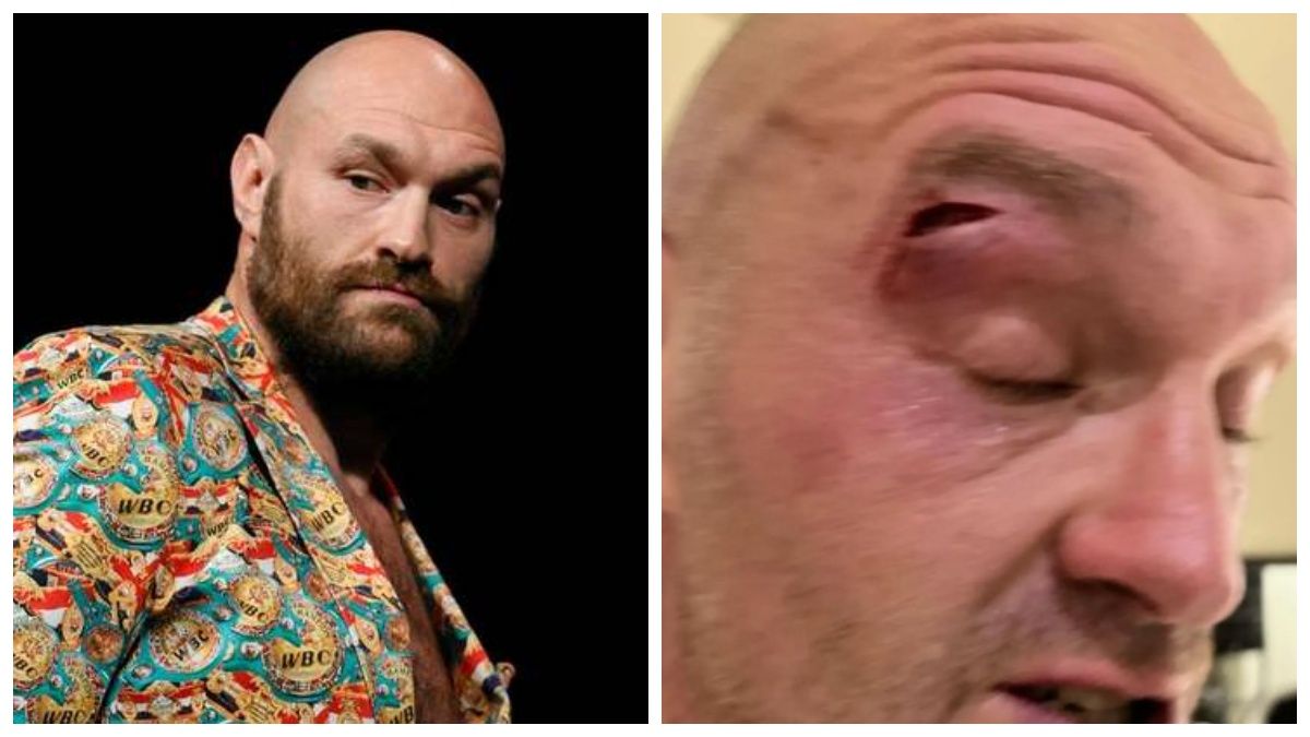 Тайсон Фьюри Тайсон Фьюри