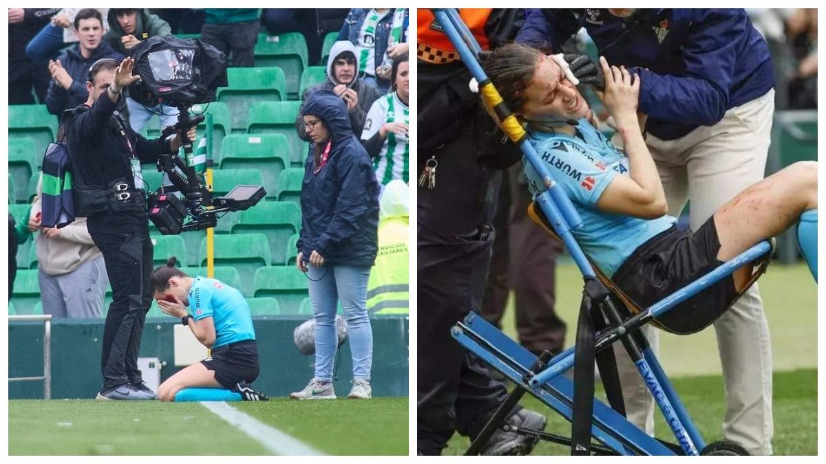 В матче Ла Лиги оператор разбил голову арбитру: жуткие фотографии - 24 канал Спорт В матче Ла Лиги оператор разбил голову арбитру: жуткие фотографии - 24 канал Спорт