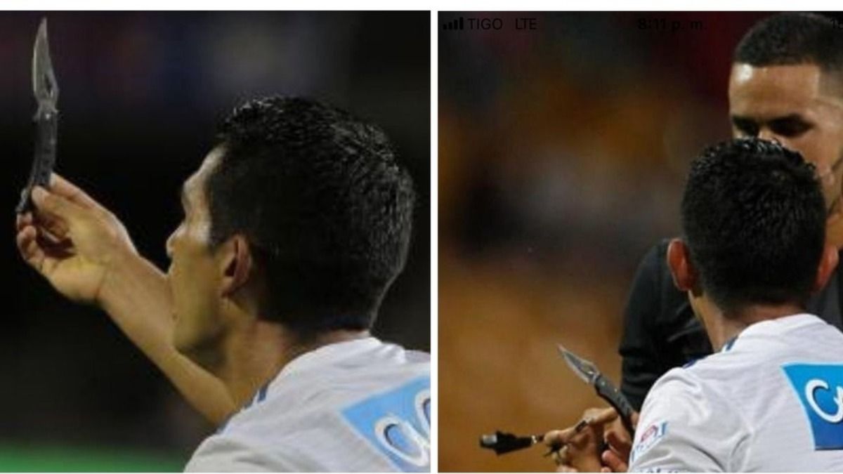 У Колумбії під час матчу вболівальник влучив ножем у голову футболіста