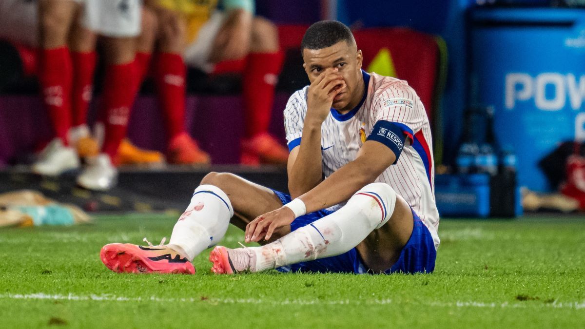 Скільки пропустить Мбаппе через перелом носа Скільки пропустить Мбаппе через перелом носа