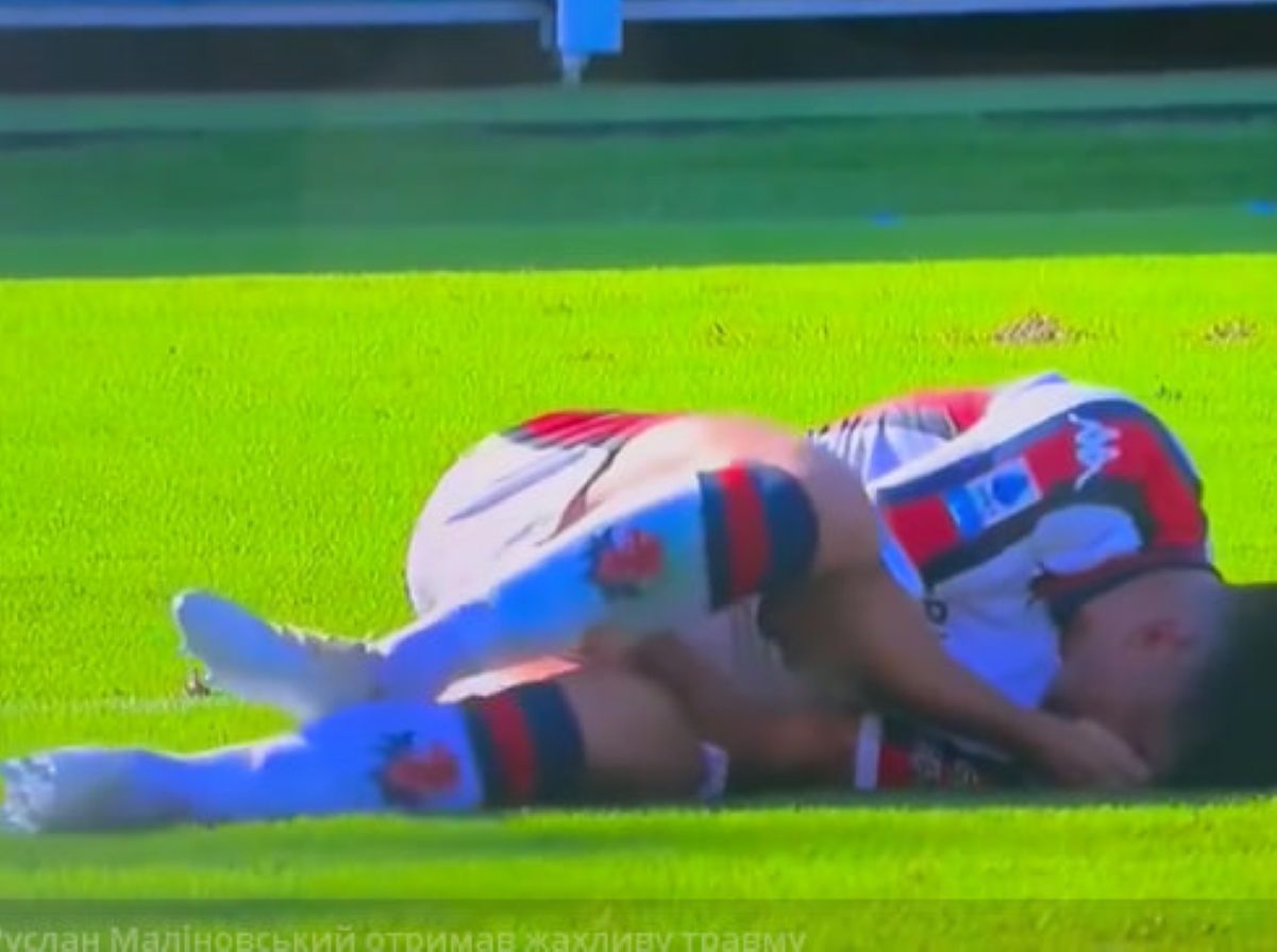 Руслан Малиновский получил ужасную травму в матче Серии А между Венецией и Джено Руслан Малиновский получил ужасную травму в матче Серии А между Венецией и Джено